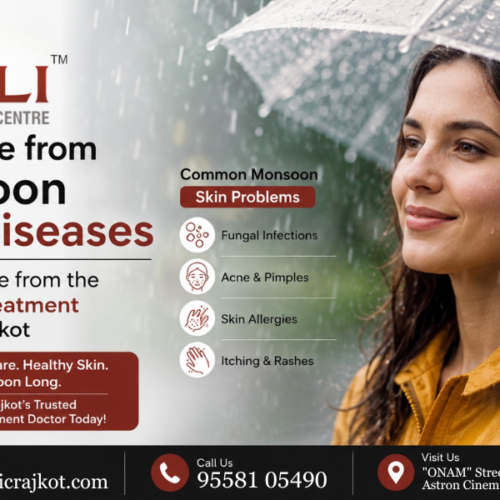 Stay Safe from Monsoon Skin Diseases with Guidance from the Best Skin Treatment Doctor in Rajkot